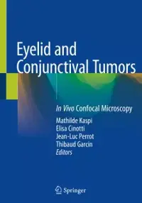 在飛比找博客來優惠-Eyelid and Conjunctival Tumors