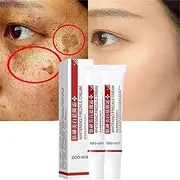 Whitening Freckle Cream, Pigmentation Removal Cream for Face, Freckle Remover Cream, Dark Spot Corrector Cream for Face Body Removes Melasma Wrinkles Pigmentation (2PCS)