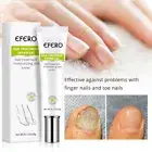 Foot Nail Fungus Removal Gel Anti-infective Onychomycosis Repair EssenHF
