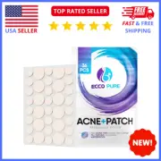 Pimple Patches: Blemish & Acne Patches, Hydrocolloid Spot Treatment