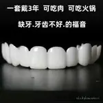 仿真牙套 永久牙齒 補缺牙 喫飯神器 老人通用補牙缺牙 自製假牙套臨時 0OZU