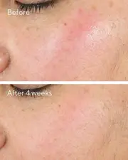 Murad Intense Recovery Cream 50ml