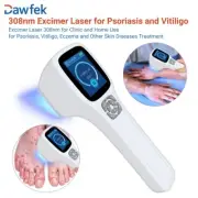 Eczema Treatment Device 308nm UVB Light Phototherpay Machine Professional 64pcs
