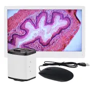 Amscope 5MP HDMI Color 1080p 15fps CMOS C-mount Microscope Camera + Monitor