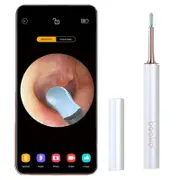 Smart Luminous Ear Pick Set Bebird T15
