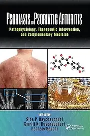 Psoriasis and Psoriatic Arthritis: Pathophysiology, Therapeutic Intervention, and Complementary Medicine