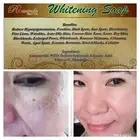 Whitening Soap Remove Dark Spot Freckles And More Best Seller 100% Effective