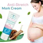 Pregnancy Scar Repair Cream Stretch Marks Removal Fat Stretch Mark Treatment NEW
