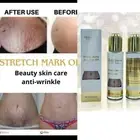 Gluta Master Stretch Marks Remover Anti Scar Oil with Collagen Clarify Skin