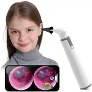 Wireless Otoscope Ear Camera with Dual View 3.9mm 720PHD WiFi Ear Scope with ...