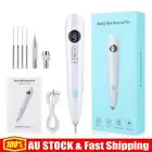 Anti-Aging Laser Plasma Pen Skin Wart Tag Tattoo Mole Removal Dark Spot Remover!