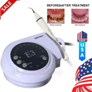 Dental Ultrasonic Scaler Piezo E3+ & handpiece tips fit Cavitron Woodpecker EMS