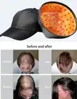 Portable LED Red Light Therapy Hair Loss Helmet Cap For Hair Regrowth Treatment