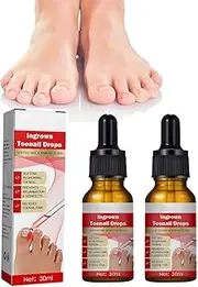 Toenail Correction Treatment Oil, Nail Helper Ingrowth Toenail Correction Treatment Oil, Ingrown Toenail Softener Oil Correction, Help Ingrowth Toenail Repair Oil (2)