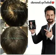 Serum grow hair mustache,beard eyebrow transplant,Solve the problem of thin hair