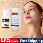 Whiting And Freckle Removing Serum Cream Dark Spot Rmover Freckle Cream Serum