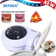 Dental Ultrasonic Piezon Scaler & Handpiece 5*Tips Compatible DTE SATELEC