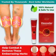 VARICOSE VEINS TREATMENT CREAM VASCULITIS PHLEBITIS SPIDER VEINS STRETCH MARKS