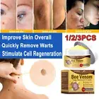 1-3X Bee Venom Comprehensive Cream Treatment Tag Care Repair Wart Remover Spot