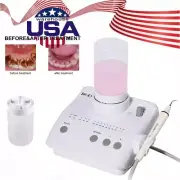 Dental Ultrasonic Piezo Scaler & 2*Water Bottles for EMS WOODPECKER FDA