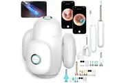 Bebird Home 30S Smart Ear Wax Removal Kit