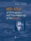 MRI Atlas of Orthopedics and Traumatology of the Knee by Peter Teller (English)