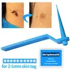 Rubber Bands Skin Tag Remover Mole Wart Tool Face Care Skin Tag Removal Kit