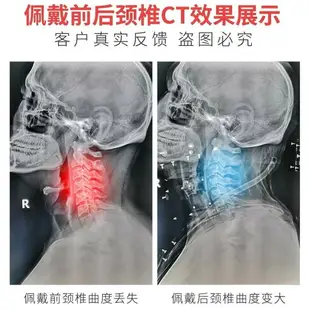 邦臣醫用頸椎牽引器家用固定頸托拉伸理療儀頸部充氣護頸矯正支撐