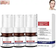 Aobenz Whitening and Freckle Removing Serum, Aobenz Spot Removing for Face, Vitamin C Face Cream, Whitening Freckle Cream, Whitening Removing Spot Serum, Anti-Aging Serum (3pcs)