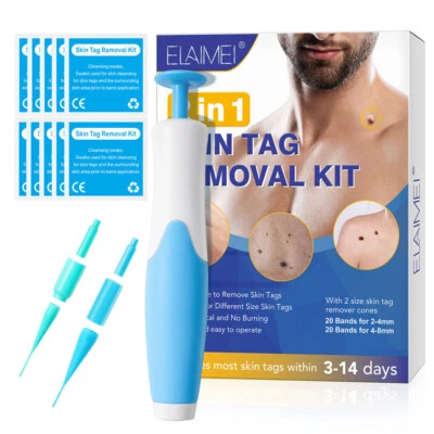 Auto Micro Skin Tag Remover Device Kit Safe Painless Removal 2-8 mm Band Tool US