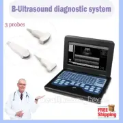 Full Digital B-Ultrasound diagnostic system Ultrasound Scanner with 3 probes
