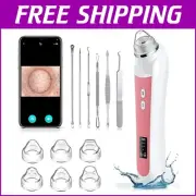 Pore Vacuum Extractor with 1080P HD Camera & 6 Adjustable Suction Levels