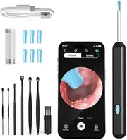 Ear Cleaner,Ear Wax Removal,Ear Cleaner With Camera And Light,Smart Visual Earwax Remove Kits with 7 Pcs Ear Set for Daily Ear Pick,6 Types of Ear Scoop Ear Tips Replacement-Black