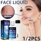 Fast Skin Tag Remover Removal Instant Treatment Safe Wart Acne Face Liquid