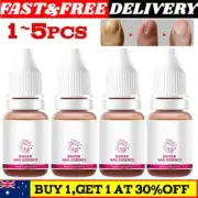 1~5pcs-FungiGone nail treatment, Fungal Nail Care Extra Strong Toe Nail Solution