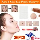 36Pcs Dermopatchy Acne & Skin Tags Pimple Remover Patch Removal Facial Care Spot