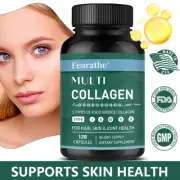 Multi Collagen Capsules - Hydrolyzed Protein Peptides -Type I,II,III,V,X