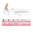 6 IN 1 Derma Roller 12 / 300 / 720 / 1200 Micro Needles Body Skin Scar Therapy