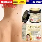 Bee Venom Skin Tag Removal Treatments Cream For Body Care Mole Corn Skin Wart