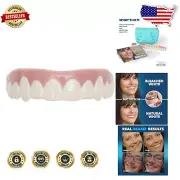 Ultra-Thin Cosmetic Teeth Uppers - Small Size for Discreet Smile Enhancement