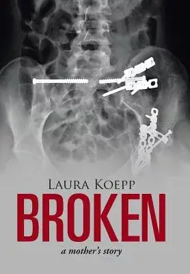 Broken: A Mother’s Story