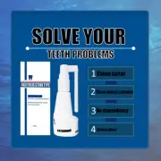 30ML Calculus Dissolving Dental Spray Natural Plant Plaque Remover For Teet GBD