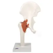 3B Scientific Functional Hip Joint Model w/ Ligaments & Marked Cartilage A81/1