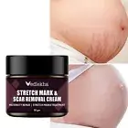 Best Scar removal Cream Skin Care for Scars Reduce Surgery Acne Stretch Marks AU