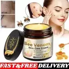 Bee Venom Skin Tag Removal Treatment Cream Body Care Mole Corn Wart Remover 1-3X
