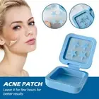 Blue Star Acne Patch Breathable Acne Treatment Skin Care Kit with Mirror Box^`