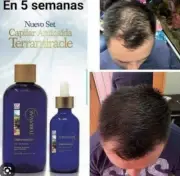 SET Terramiracle Hair Loss Treatment And Shampoo By Terramar