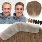 Men Forehead Hairline Toupee 100% Human Hair Skin PU Hairpieces Frontal Topper