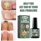 ﹑Nail Fungus Treatment Repair Essence to Remove Foot Toe Fungal Anti-Infection*/