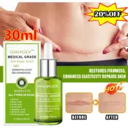 GOOPGEN Advanced Scar Repair Serum--50% OFF-US